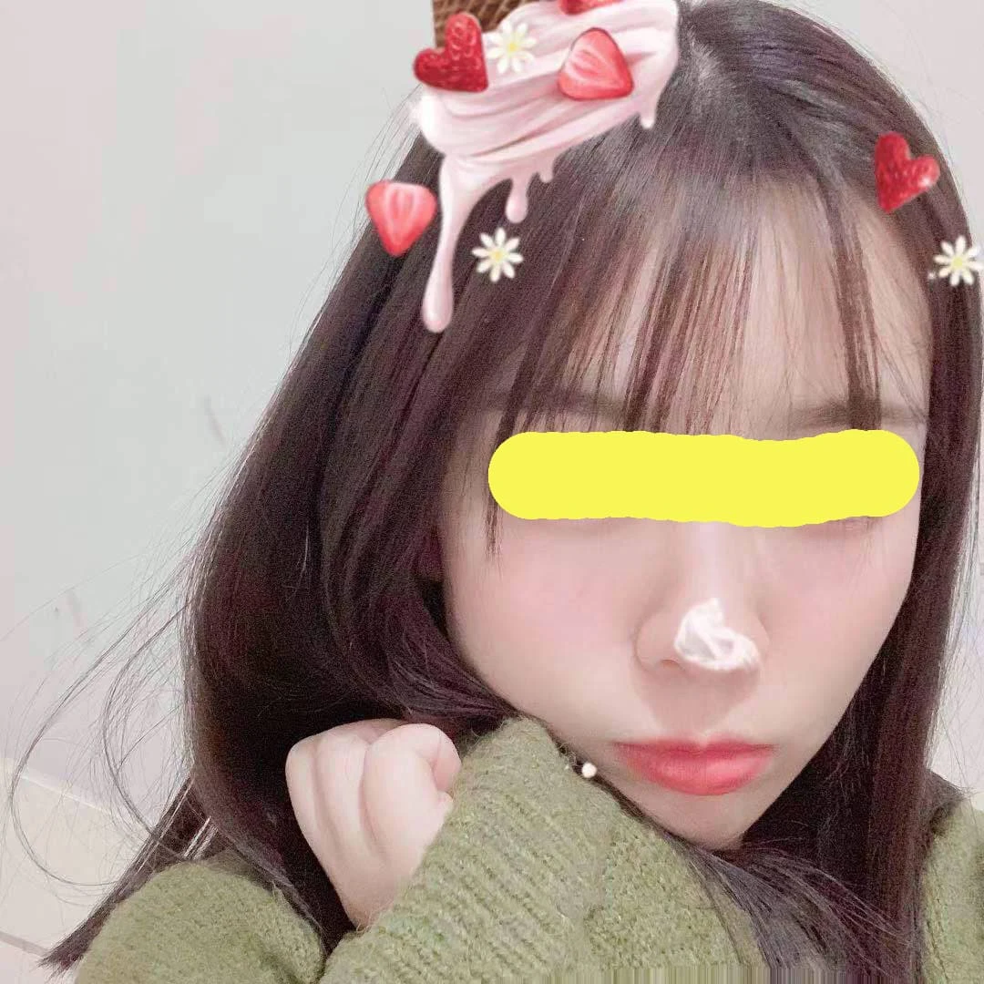 女生戴草莓发饰,鼻尖沾白霜